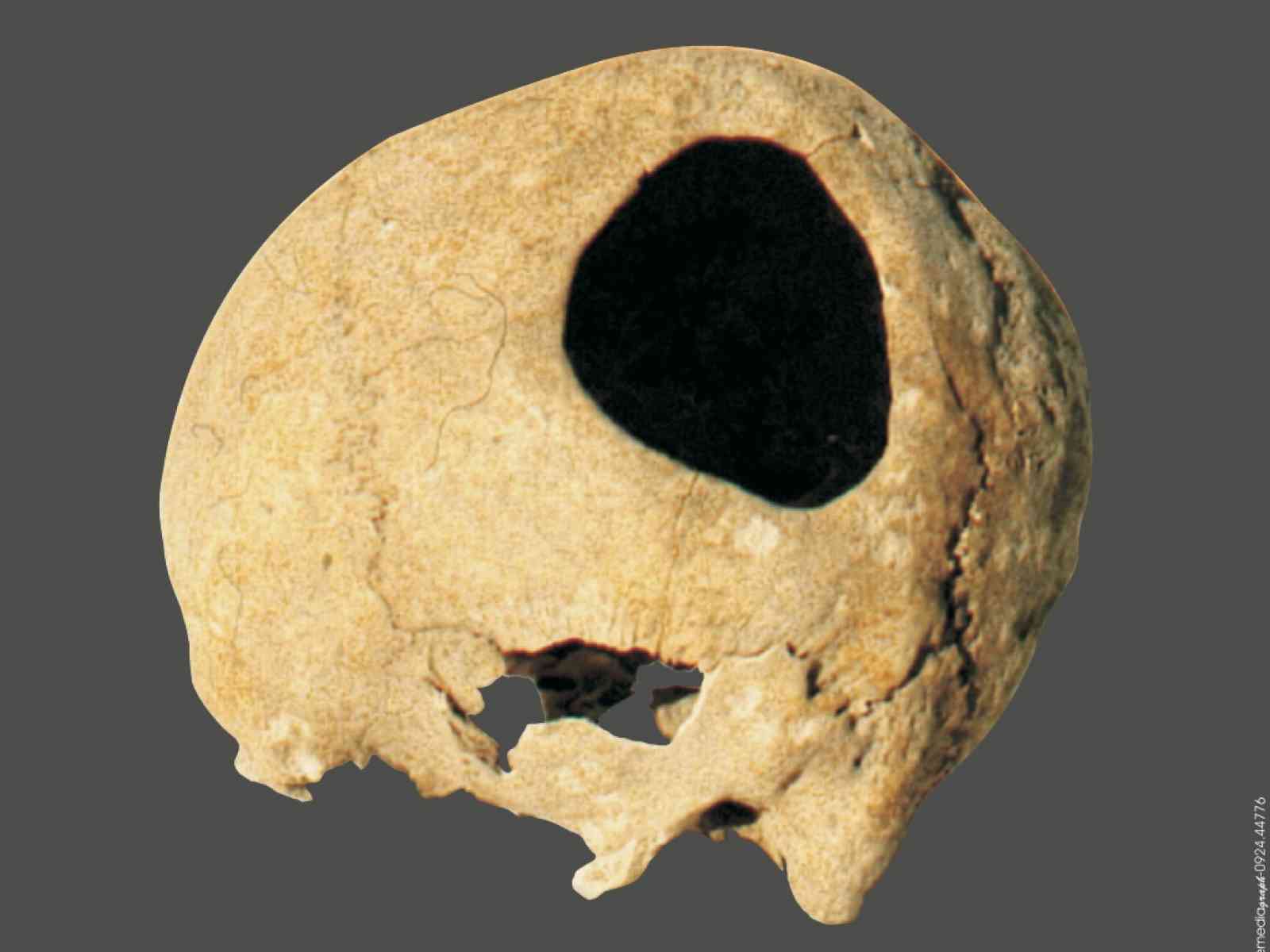 Ritorna nel Belìce il cranio ritrovato tra Partanna e Montevago risalente all'età del bronzo